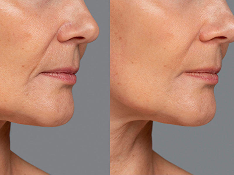 A radiant transformation